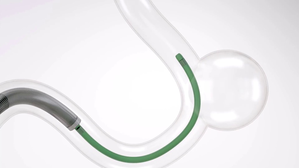 FRED Flow Diverter — Terumo Neuro